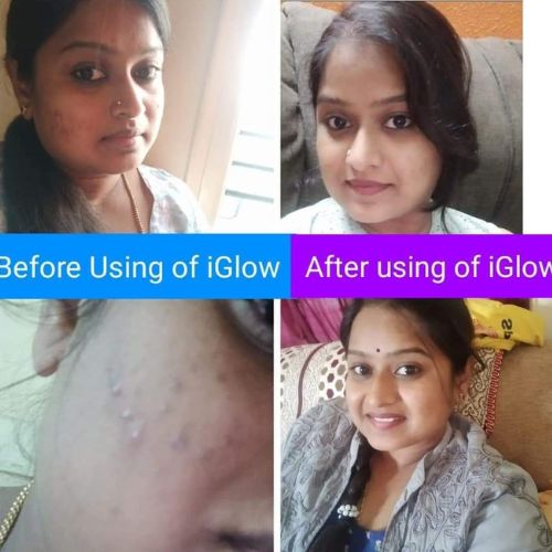 Indusviva iGlow Review